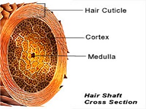 Hair shaft_disorders1